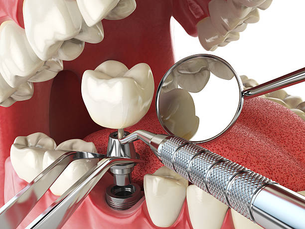 Best Emergency Denture Repair in Far Hills, NJ
